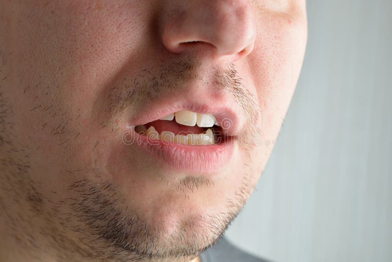 Lips, short beard of a young man. Concept photo of male sexuality and skin medical care royalty free stock photography