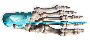 The Calcaneus is on the lateral side of the foot for load bearing